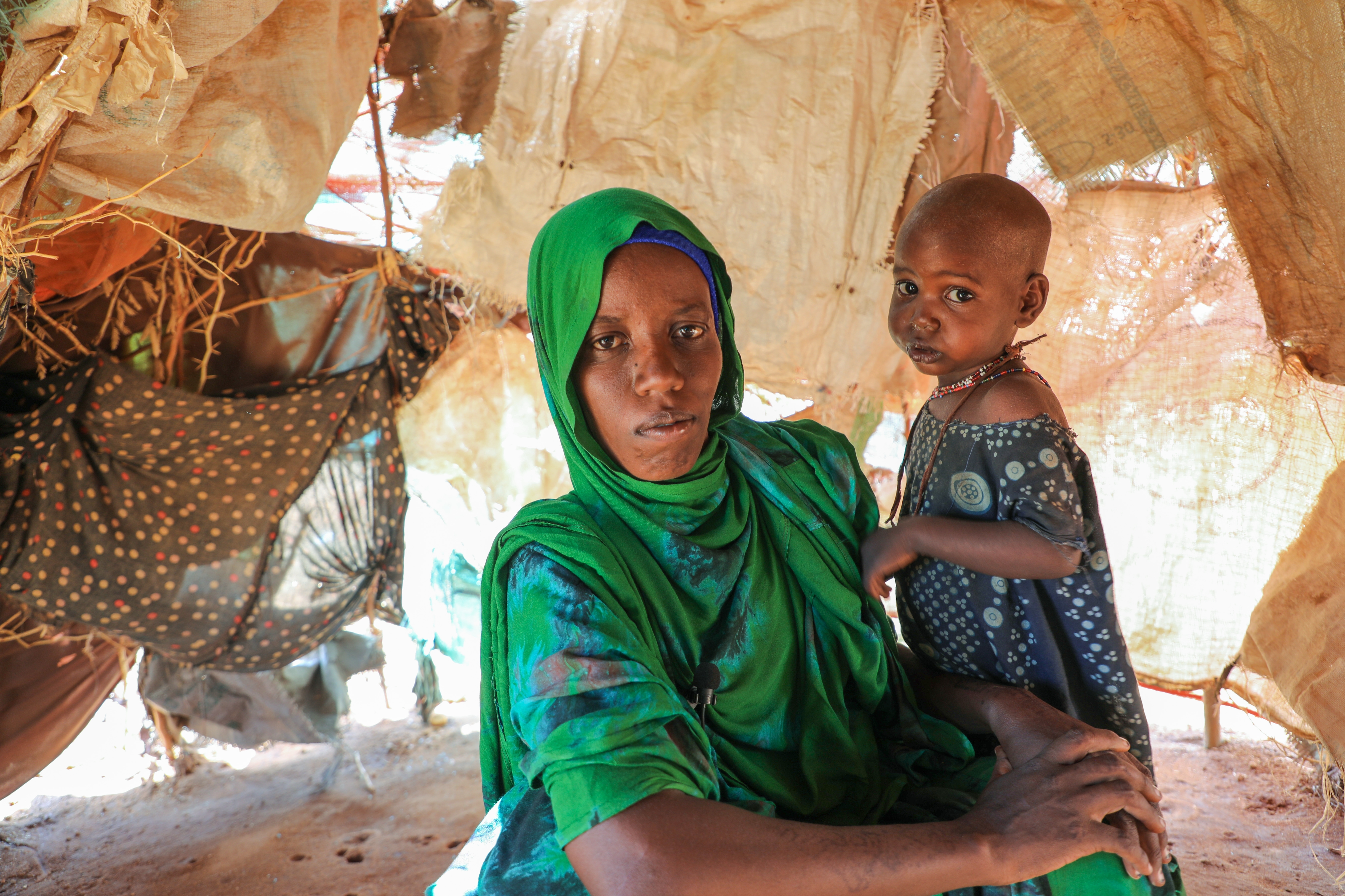 Somali children are ‘on the edge’ as hunger spreads. UNICEF says Iran war has worsened the crisis